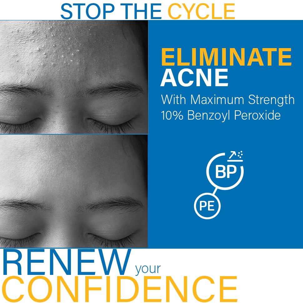 DCL B Prox 10 Anti-Blemish Wash for Acne-Prone Skin - dsonline.me