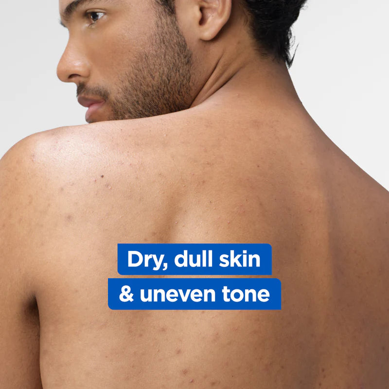Mixa Niacinamide Bright Body Lotion For Dry & Dull Skin in Need of Unifying With Shea Butter, Niacinamide & Vitamin C