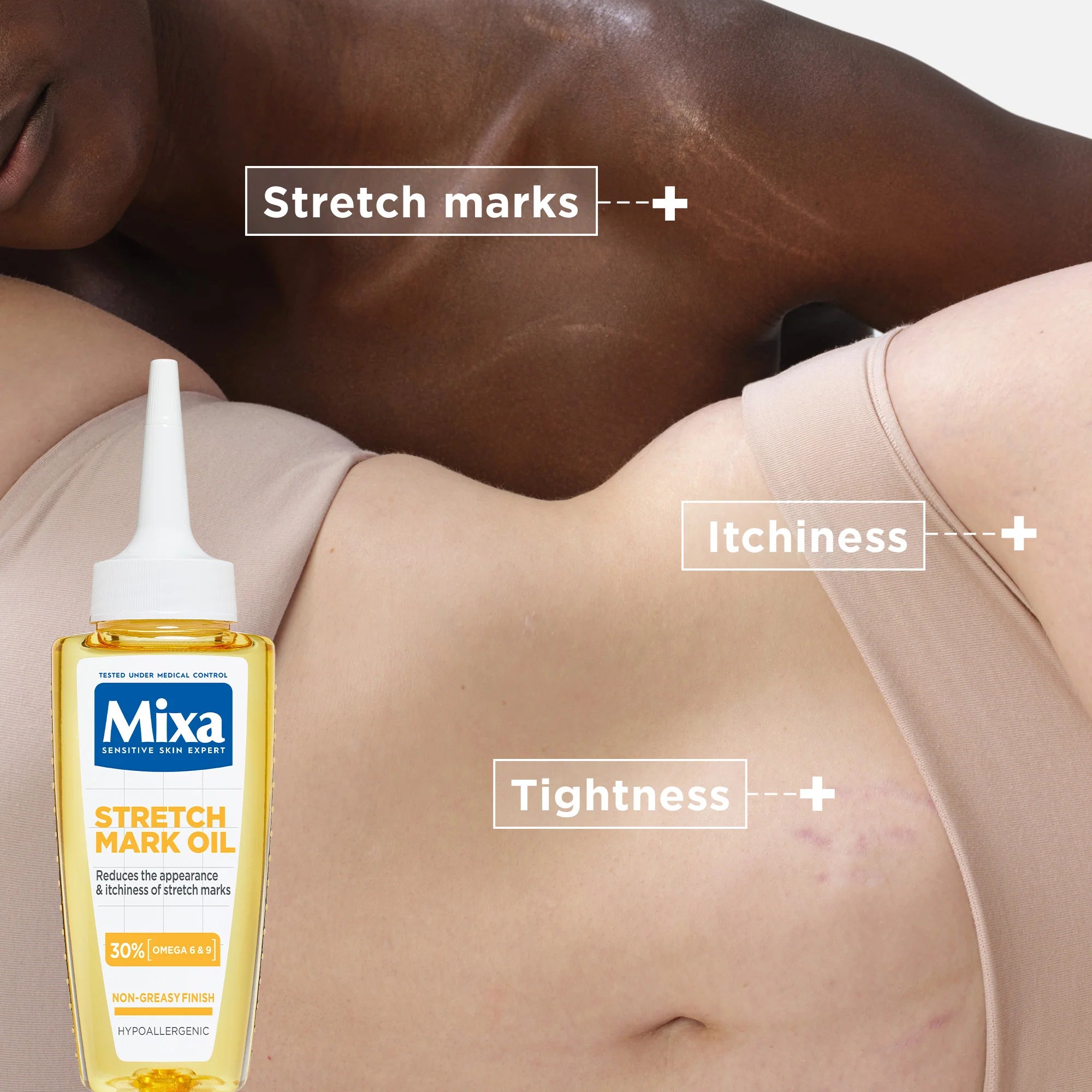 Mixa Anti Stretch Mark Oil For Skin with Stretch Marks With Omega 6 & 9