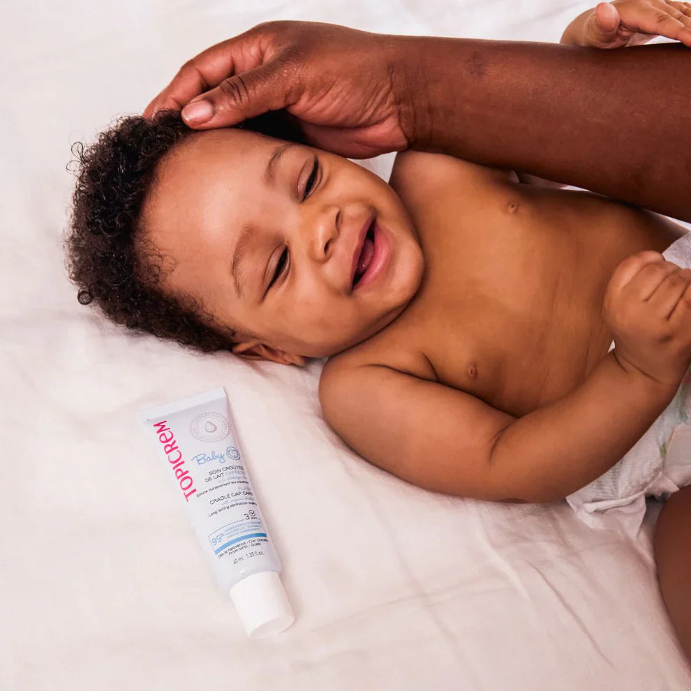 Topicrem Baby flash cradle cap care 40ml