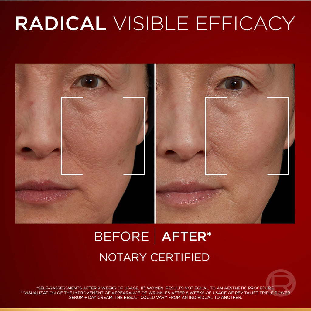 L’Oréal Paris Revitalift Triple Power Age-Correcting™ Serum with Tri-peptides, Hyaluronic Acid, and Vitamin C to Hydrate, Tone, and Firm Skin, 30ml