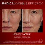 L’Oréal Paris Revitalift Triple Power Age-Correcting™ Serum with Tri-peptides, Hyaluronic Acid, and Vitamin C to Hydrate, Tone, and Firm Skin, 30ml