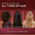 L'Oréal Paris Elvive Fall Resist Anti Hair-Fall Serum With Aminexil 102ml