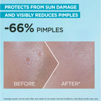 Garnier Super UV Anti-Acne SPF50+ Sunscreen – 12H Oil Control