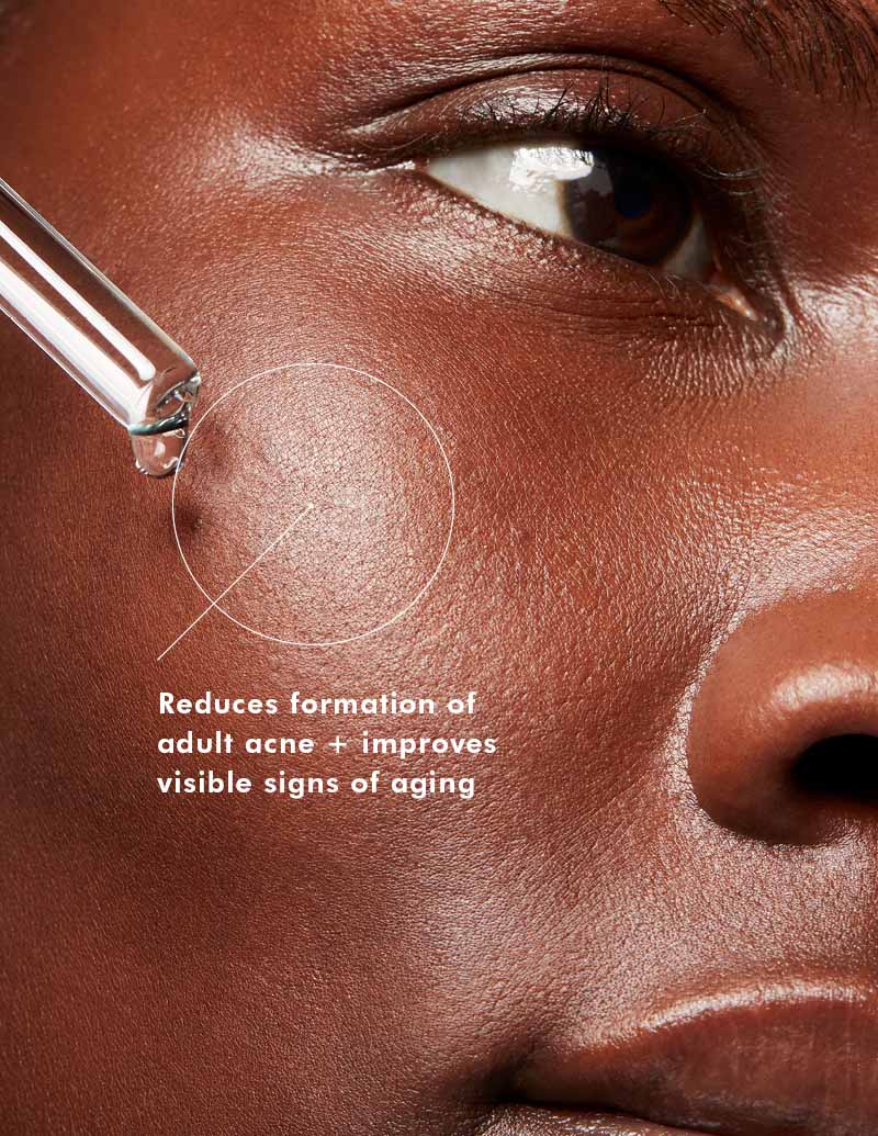SkinCeuticals Blemish + Age Defense
