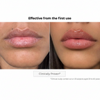 Kosmopellis Microneedling Lip Patch