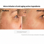 Kosmopellis Microneedling Anti-Aging Patch