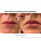 Kosmopellis Microneedling Lip Patch