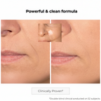 Kosmopellis Microneedling Anti-Aging Patch