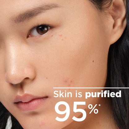 Bioderma Sébium H2O Micellar Water 500ml bottle, purifying micellar solution for oily and acne-prone skin, gently removes makeup and cleanses without drying