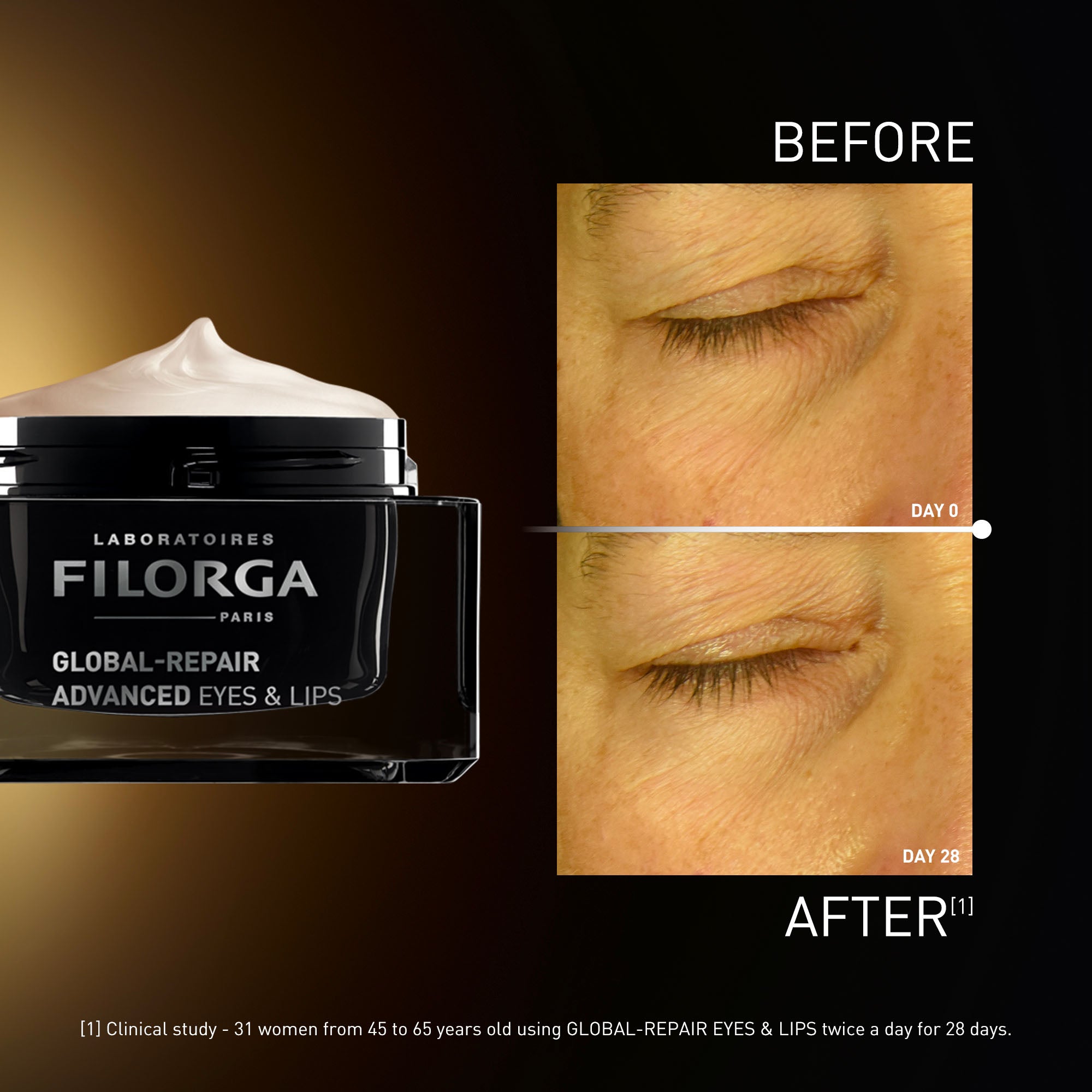 Filorga Global Repair Advanced Eyes & Lips 15ml