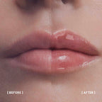 Filorga Hyalu Filler Lips