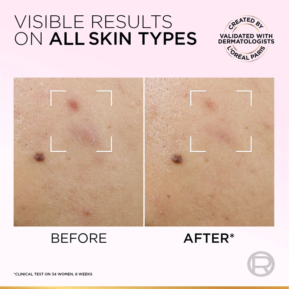 L'Oréal Paris Glycolic-Bright Anti-Dark Spot Exfoliant Peel 15% AHA + BHA + PHA + Niacinamide 25ml.
