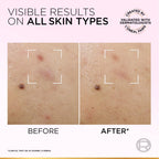 L'Oréal Paris Glycolic-Bright Anti-Dark Spot Exfoliant Peel 15% AHA + BHA + PHA + Niacinamide 25ml.