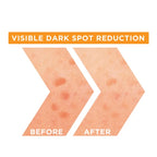 Garnier Skin Active Fast Bright Vitamin C + Niacinamide 30x Brightening Booster Day Serum