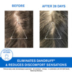 Uriage D.S. Hair Anti-Dandruff Treatment Shampoo - Moderate Dandruff & Irritated Scalp