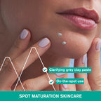 Uriage Hyseac SOS Paste - Local Skin-Care - Oily Skin with Blemishes