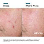 SkinCeuticals Advanced RGN-6 Regenerative Cream