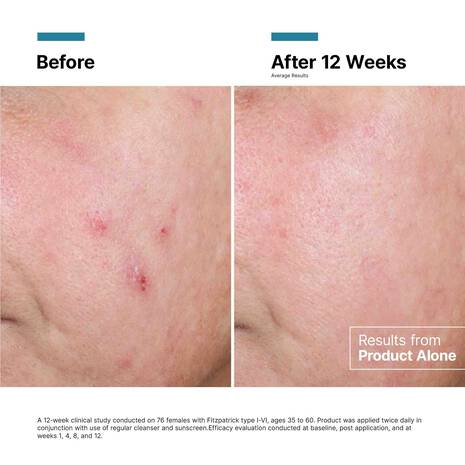 SkinCeuticals Advanced RGN-6 Regenerative Cream