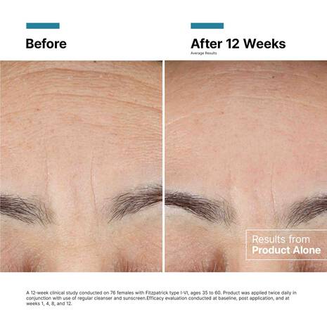 SkinCeuticals Advanced RGN-6 Regenerative Cream