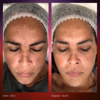 Primaderm RADIANT DUAL SERUM 30ML