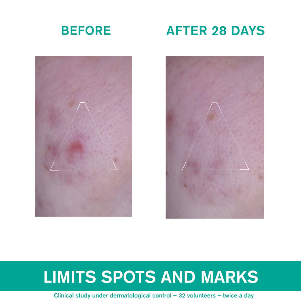 Uriage Hyseac 3-Regul + Anti-Blemish Global Care 40 ml