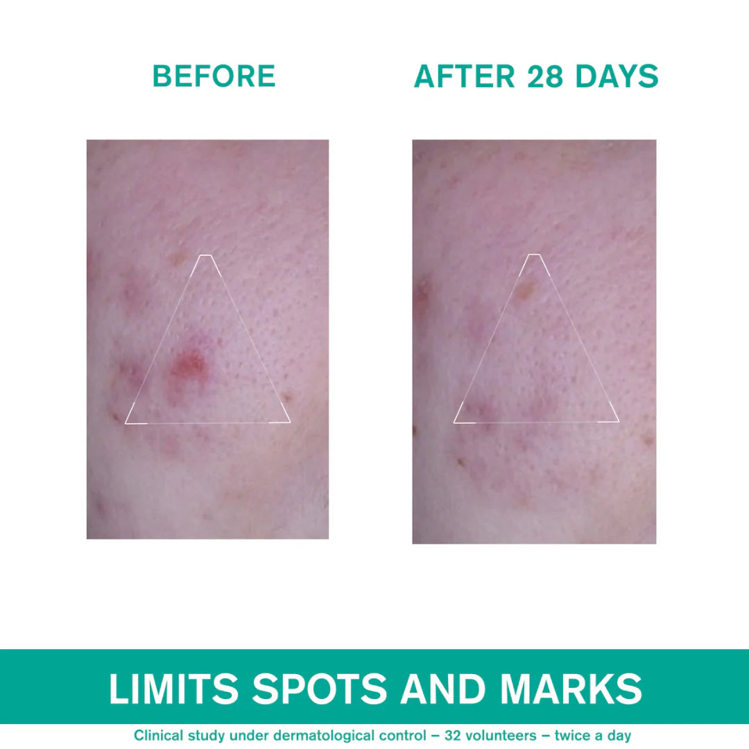 Uriage Hyseac 3-Regul + Anti-Blemish Global Care 40 ml