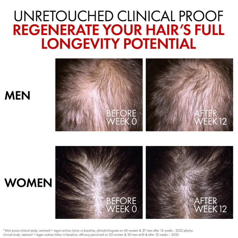 Vichy Dercos Aminexil Clinical R.E.G.E.N. Booster Hair Serum