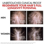 Vichy Dercos Aminexil Clinical R.E.G.E.N. Booster Hair Serum
