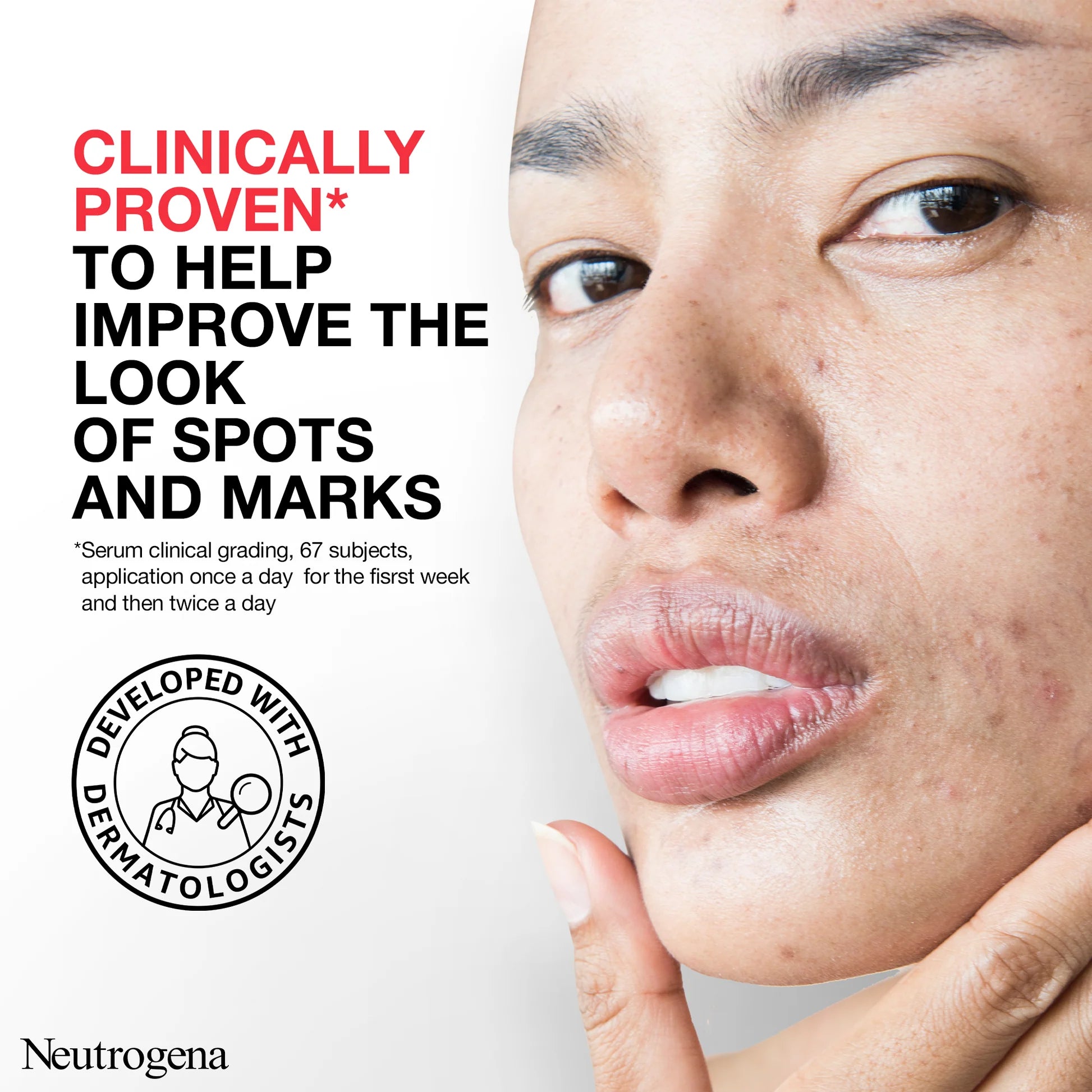 Neutrogena Spot Controlling+ Serum , Boosts Skin Radiance, powerful combination of Salicylic acid - a purifying agent and glycolic acid, 30ml