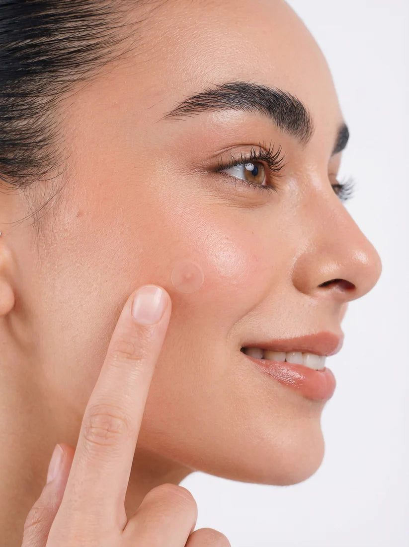 Woman pointing to a blemish on her face against a white background
