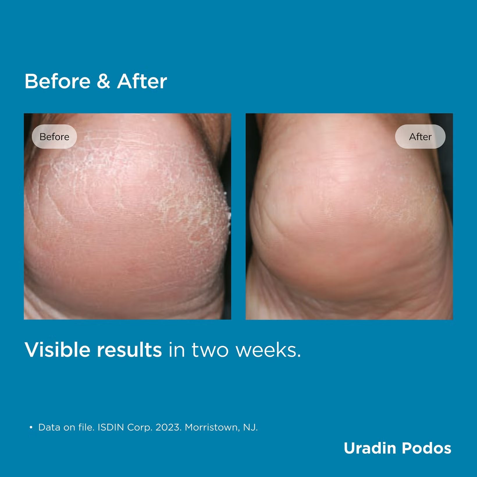 ISDIN Foot Care Uradin Podos Hydrating Gel Oil
