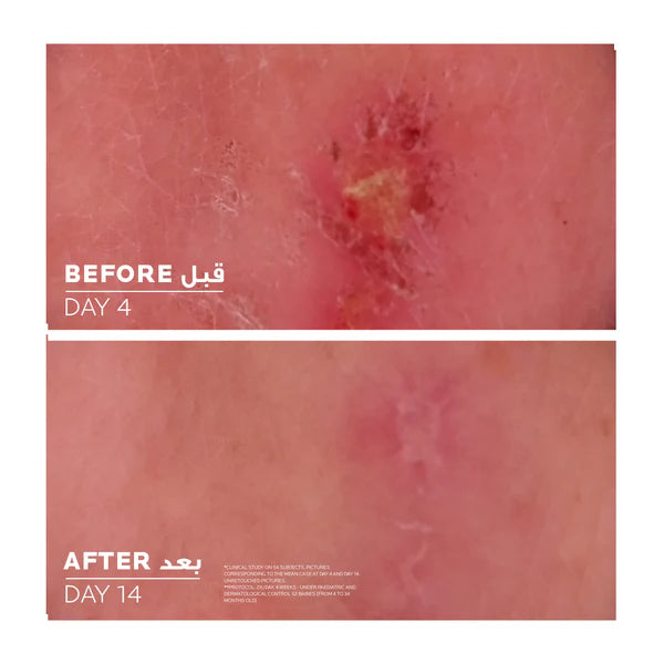 La Roche-Posay Cicaplast Baume B5+ 40ml – Baume multi-réparateur apaisant, enrichi en vitamine B5 et beurre de karité, pour protéger et régénérer les peaux irritées et fragilisées