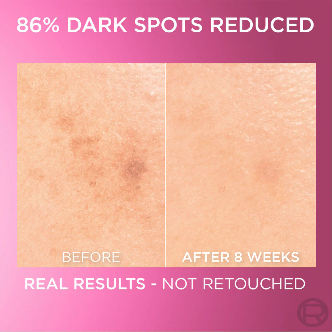L'Oreal Paris Glycolic Bright Face Serum, With 8% [Melasyl ™ + Glycolic Acid + Niacinamide], for Dark Spots and Brightening 30ml