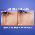 L’Oréal Paris Revitalift Laser Retinol Deep Wrinkle Night Serum, With Vitamin A, Targets all Wrinkles, 30ml